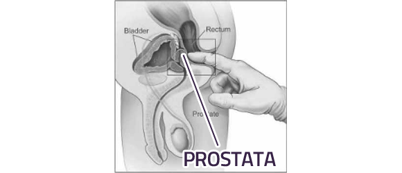 Poloha prostaty v mužském těle